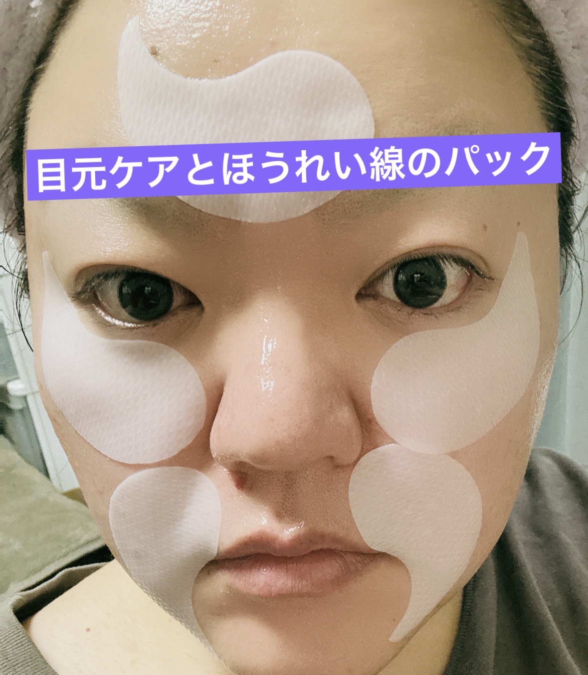 プロバイオダーム コラーゲン リモデリング アイパッチ/BIOHEAL BOH/アイケア・アイクリームを使ったクチコミ（2枚目）