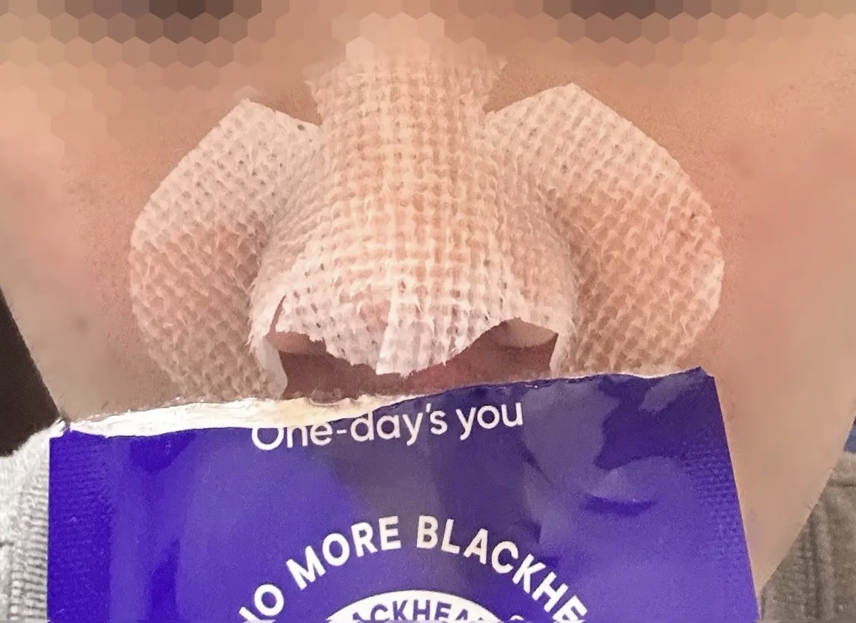 ノーモアブラックヘッド(ノーズピーリング)/One-day's you/スクラブ・ゴマージュを使ったクチコミ（2枚目）