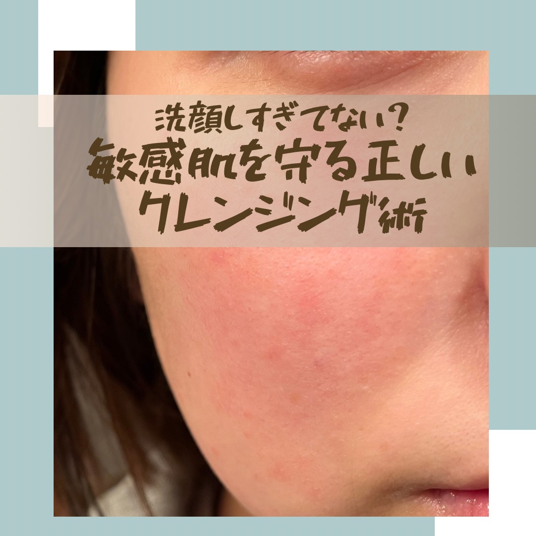 ミノン アミノモイスト ジェントルウォッシュ ホイップ/ミノン/泡洗顔を使ったクチコミ（1枚目）