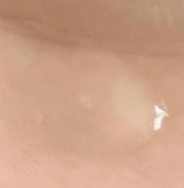 ミノン アミノモイスト 薬用アクネケア ローション/ミノン/化粧水を使ったクチコミ(2枚目)