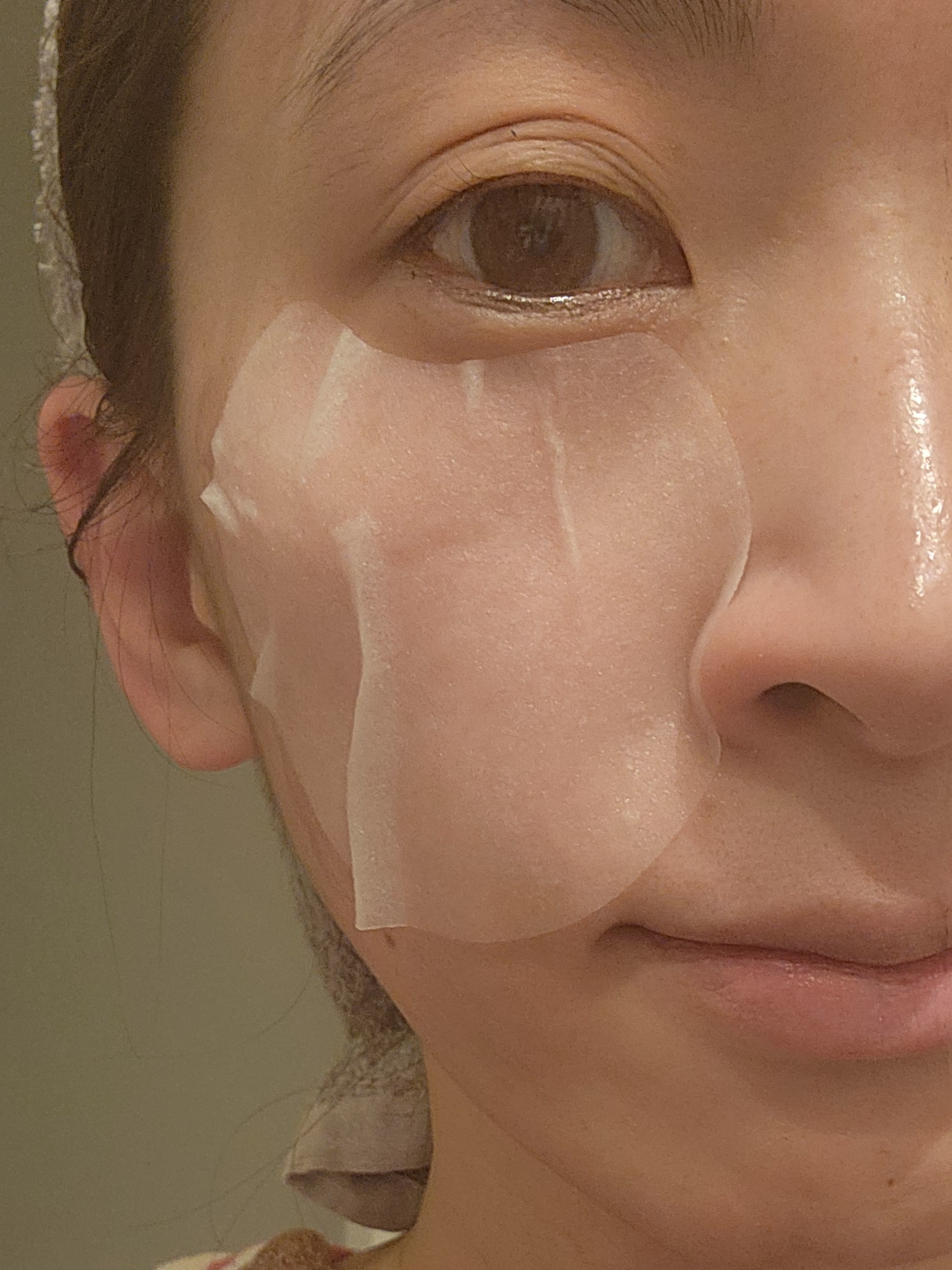 センテラ クイックカーミングパッド/SKIN1004/トナーパッドを使ったクチコミ（3枚目）