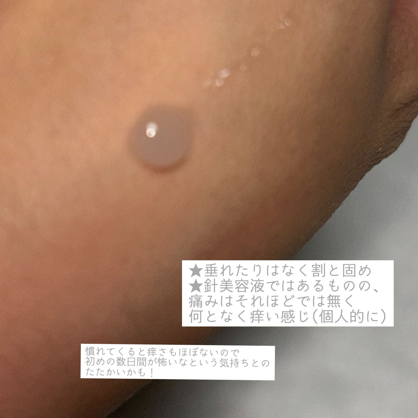 ゼロ1DAYエクソソームショット2000/MEDICUBE/美容液を使ったクチコミ(2枚目)