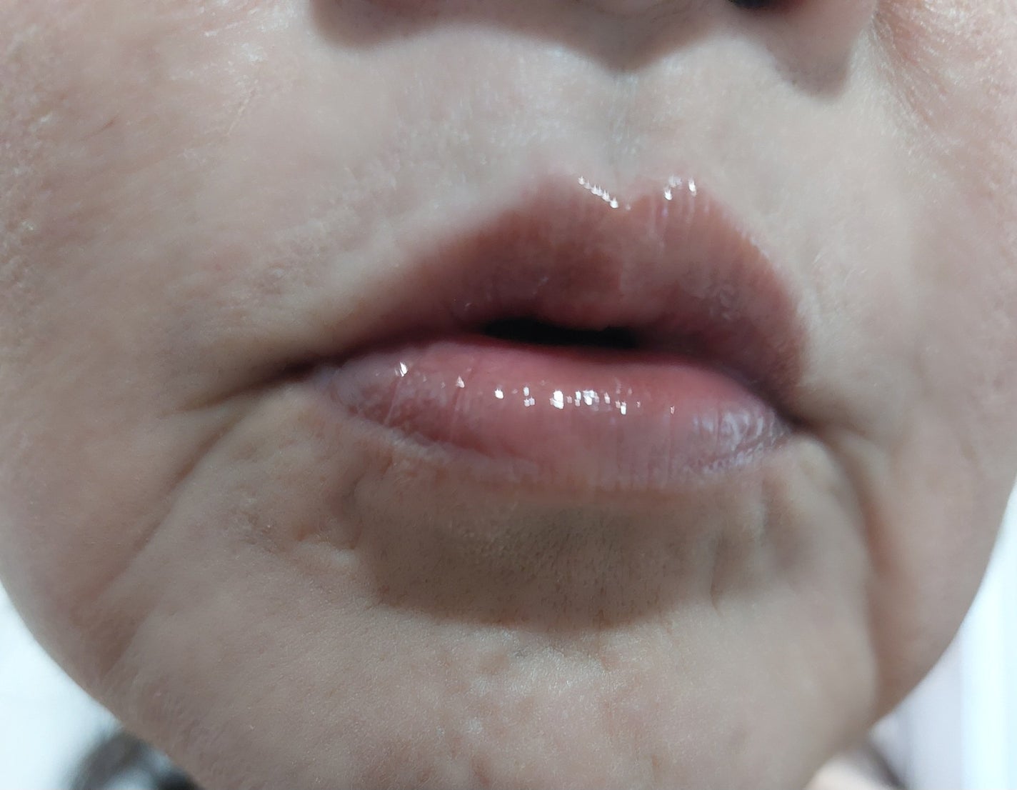 エテルナムリップセラム /エテルナム/リップ美容液を使ったクチコミ(5枚目)