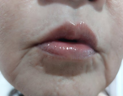 エテルナムリップセラム /エテルナム/リップ美容液を使ったクチコミ(5枚目)