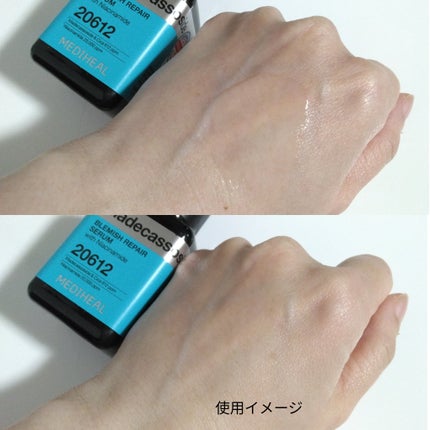 マデカソサイドブレミッシュリペアセラム/MEDIHEAL/美容液を使ったクチコミ(3枚目)