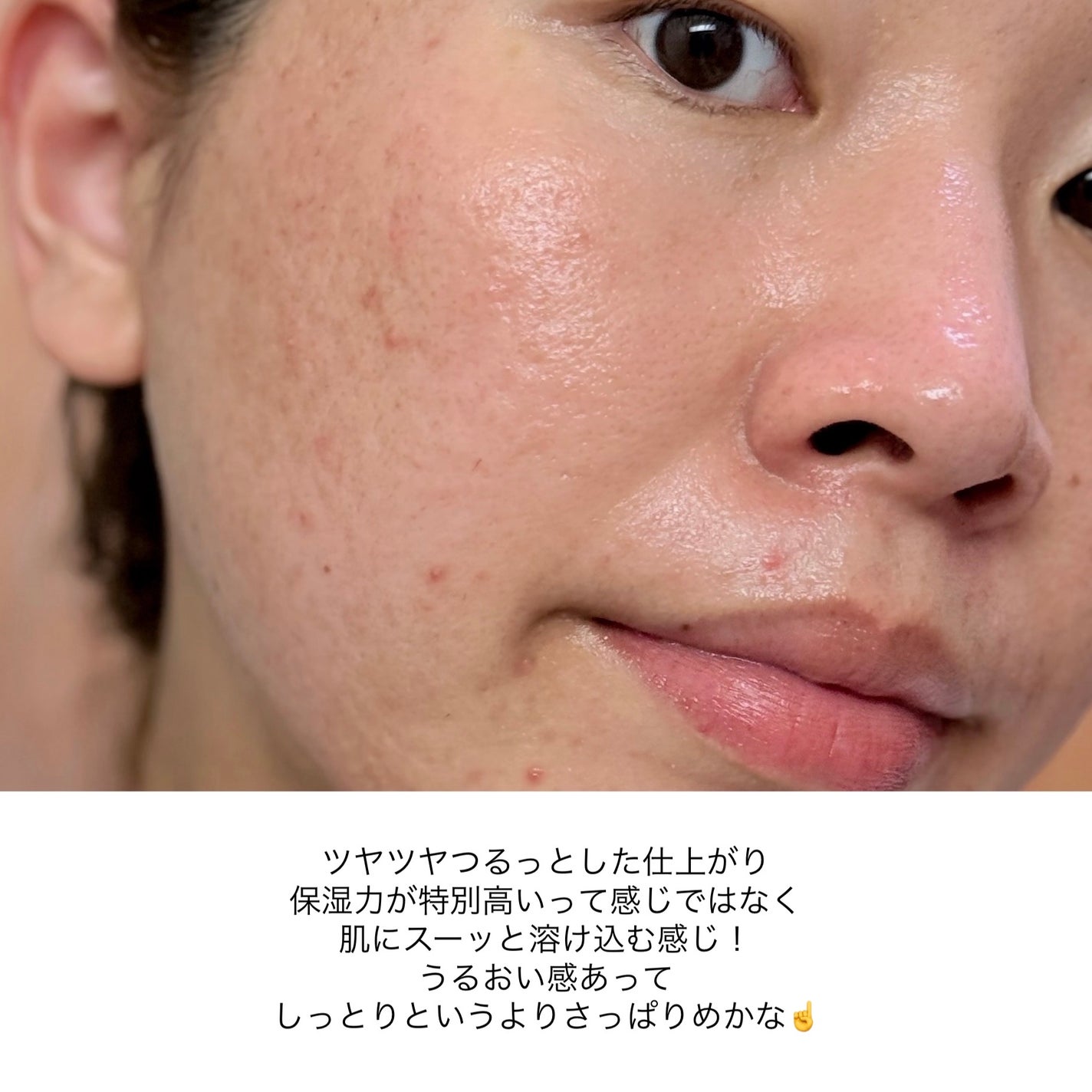 アスタキサンチンアンプル/Dr.Melaxin/美容液を使ったクチコミ(4枚目)