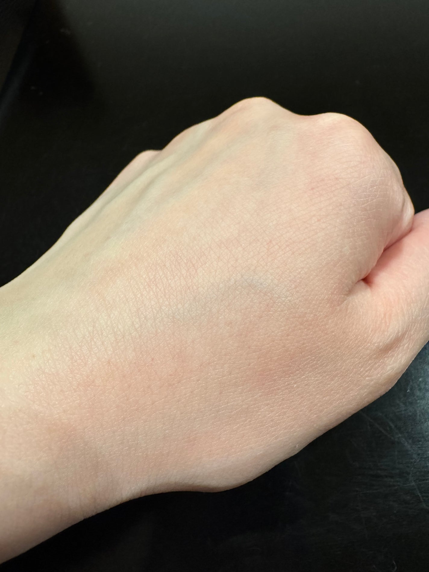 プロバイオシカ インテンシブ アンプル/SKIN1004/美容液を使ったクチコミ(2枚目)