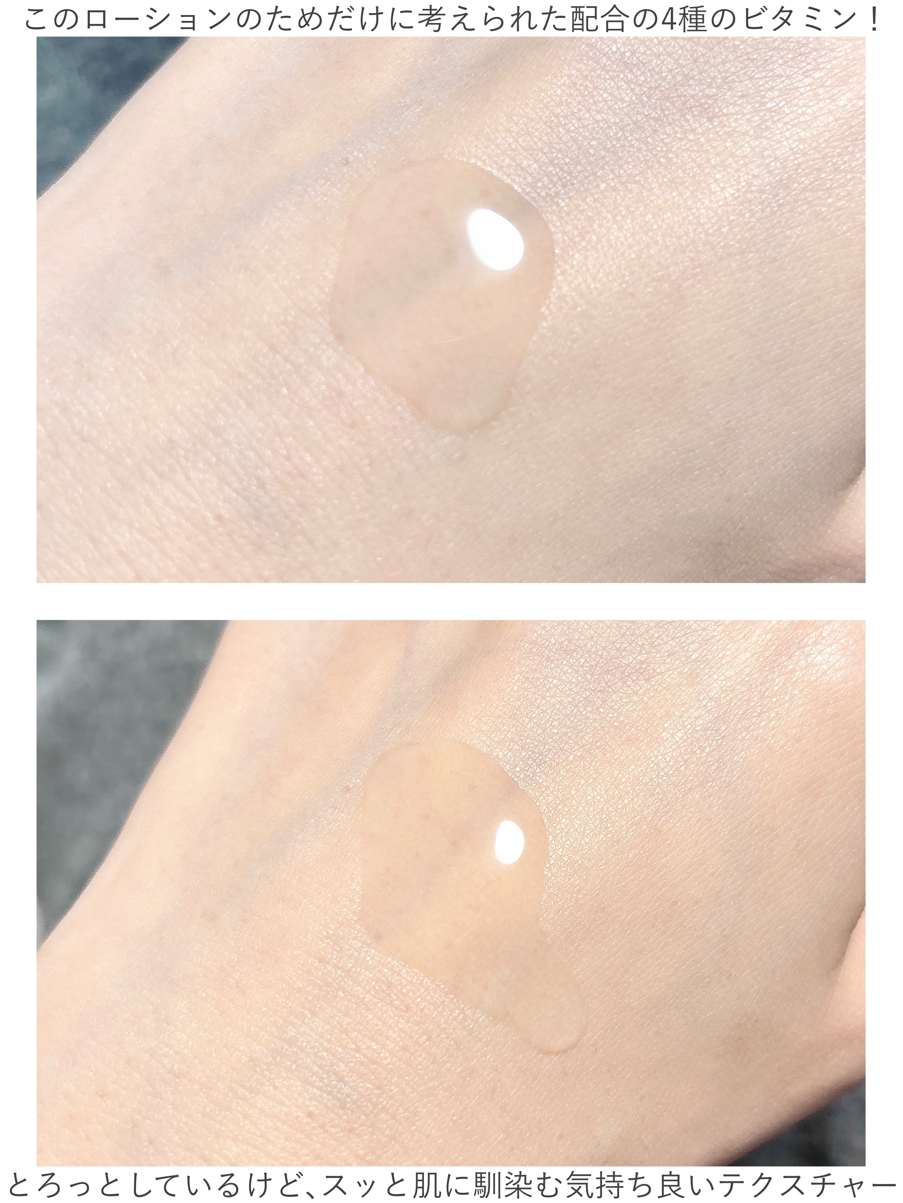 オバジC クリアアドバンスドローション/オバジ/化粧水を使ったクチコミ（2枚目）