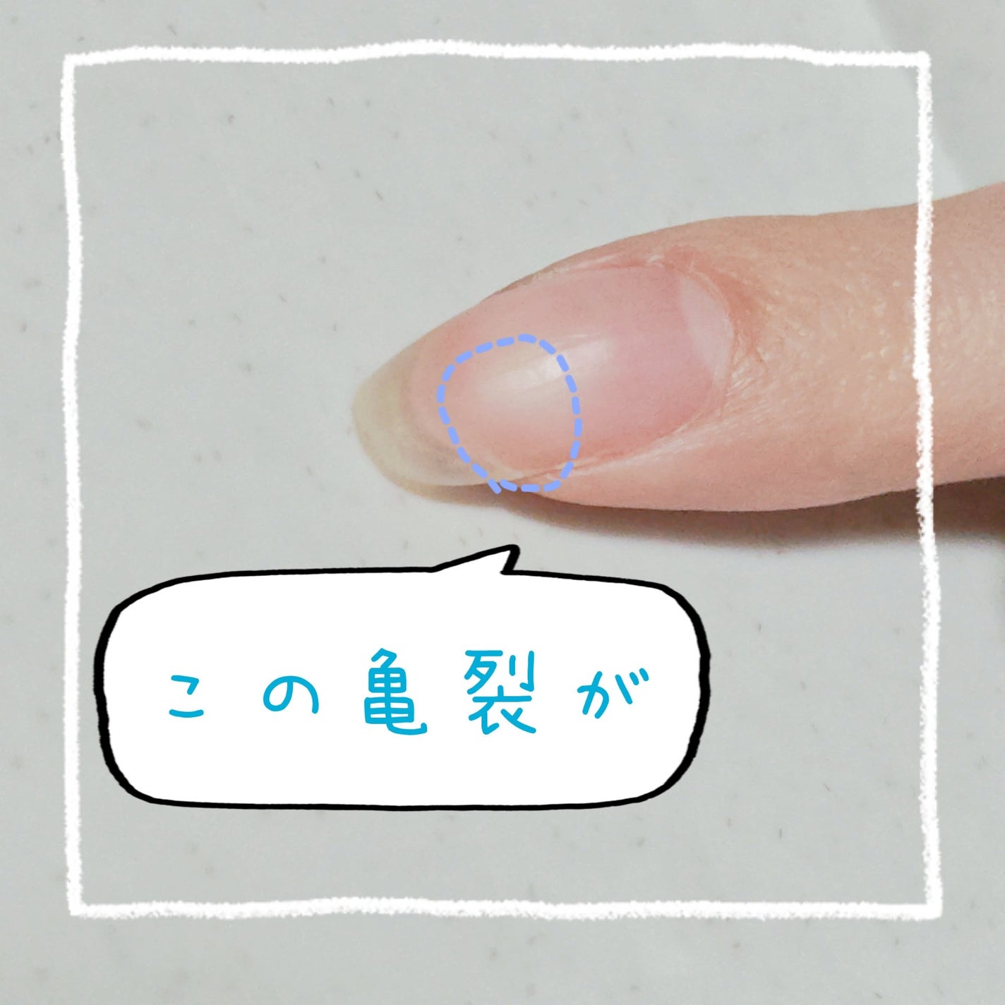 紫音@なるべくフォロバ on LIPS 「シルクシート写真2枚目が補修前、3枚目が補修後になります👀割れ..」(2枚目)