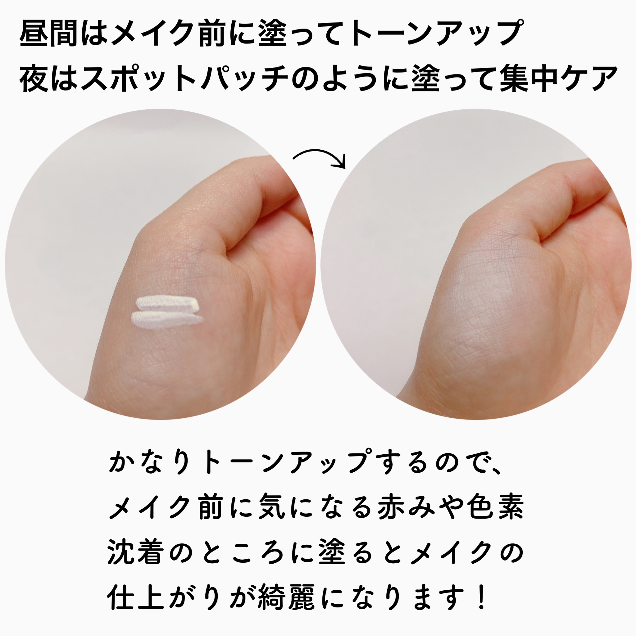 メラターンスポットクリア/リリーイブ/その他スキンケアを使ったクチコミ（2枚目）