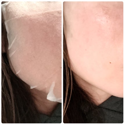 kico on LIPS ãðDr.Gããã¯ã¿ãŒãžãŒãã¬ãããã¬ããã·ã¥ã¯ã€ãã¯PHAã·ãŒ..ãïŒ5æç®ïŒ