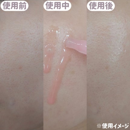 PDRNピンクアンプル PDRN 10,000ppm配合/MEDICUBE/美容液を使ったクチコミ(3枚目)
