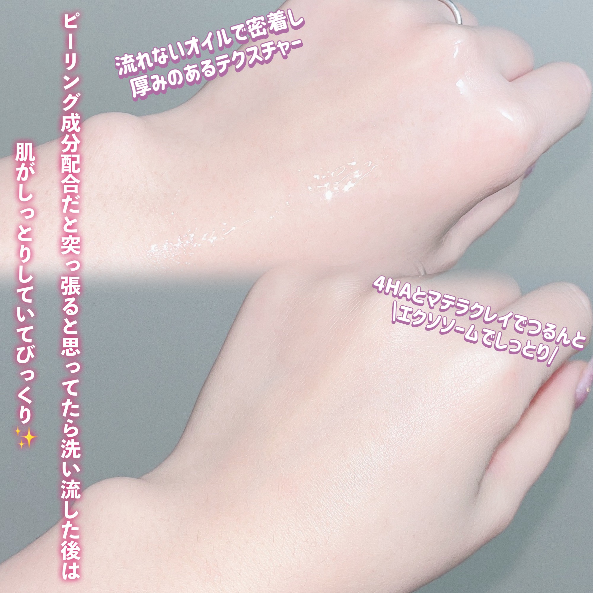 EXO ピールメンテナンスオイル/クレンジングリサーチ/オイルクレンジングを使ったクチコミ（3枚目）