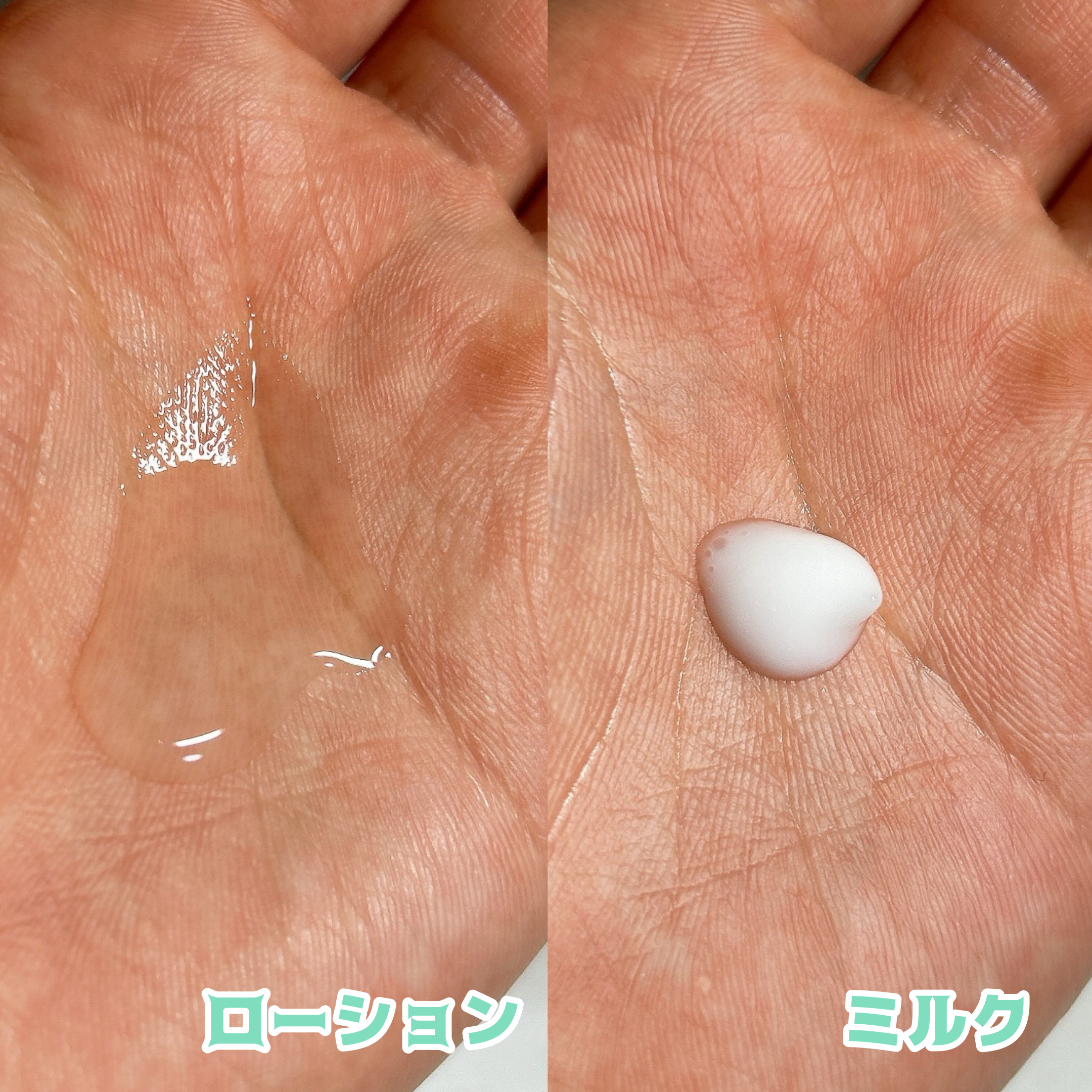 ミノン アミノモイスト 薬用アクネケア ローション/ミノン/化粧水を使ったクチコミ（3枚目）