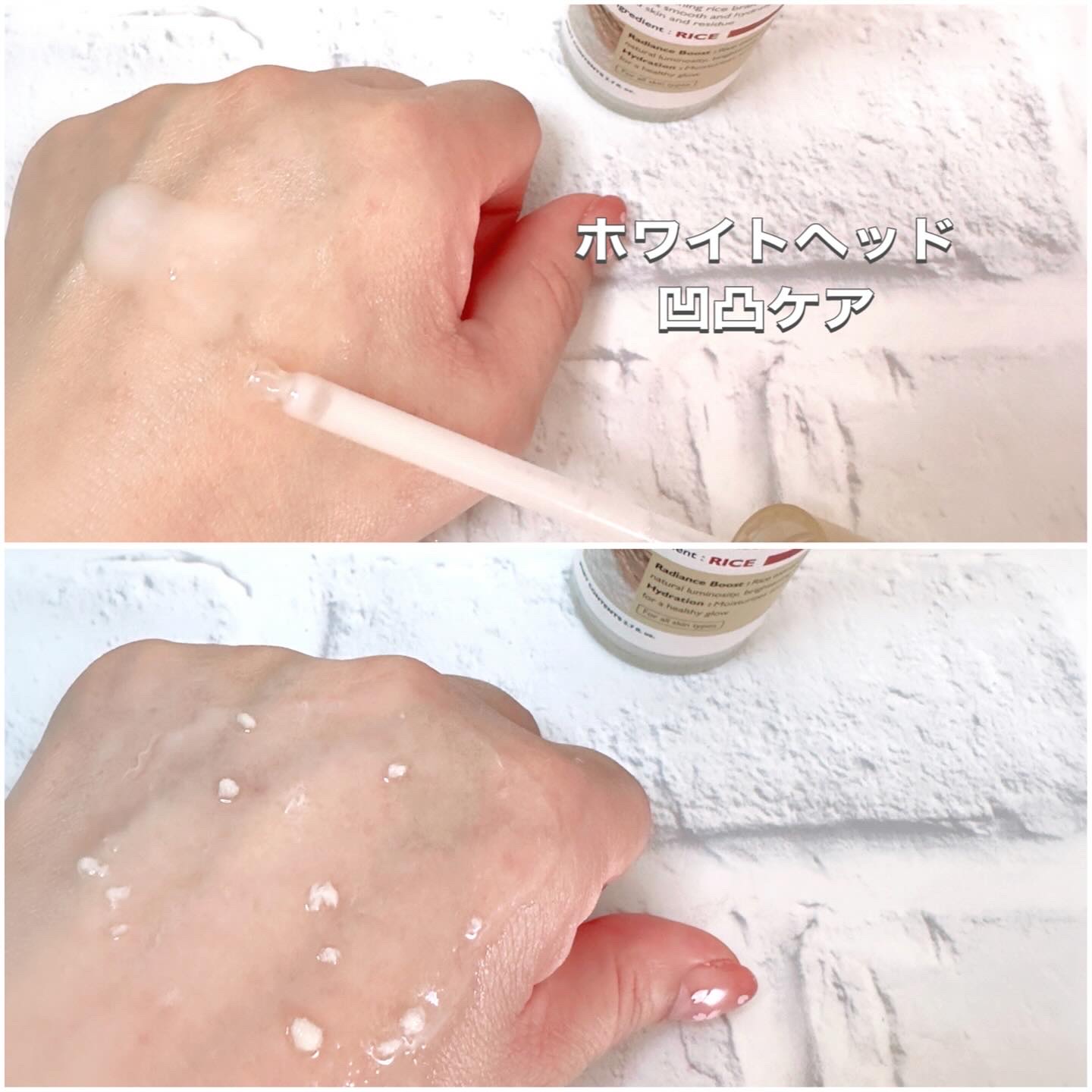 白米ピールショットゴマージュアンプル/Dr.Melaxin/美容液を使ったクチコミ（3枚目）