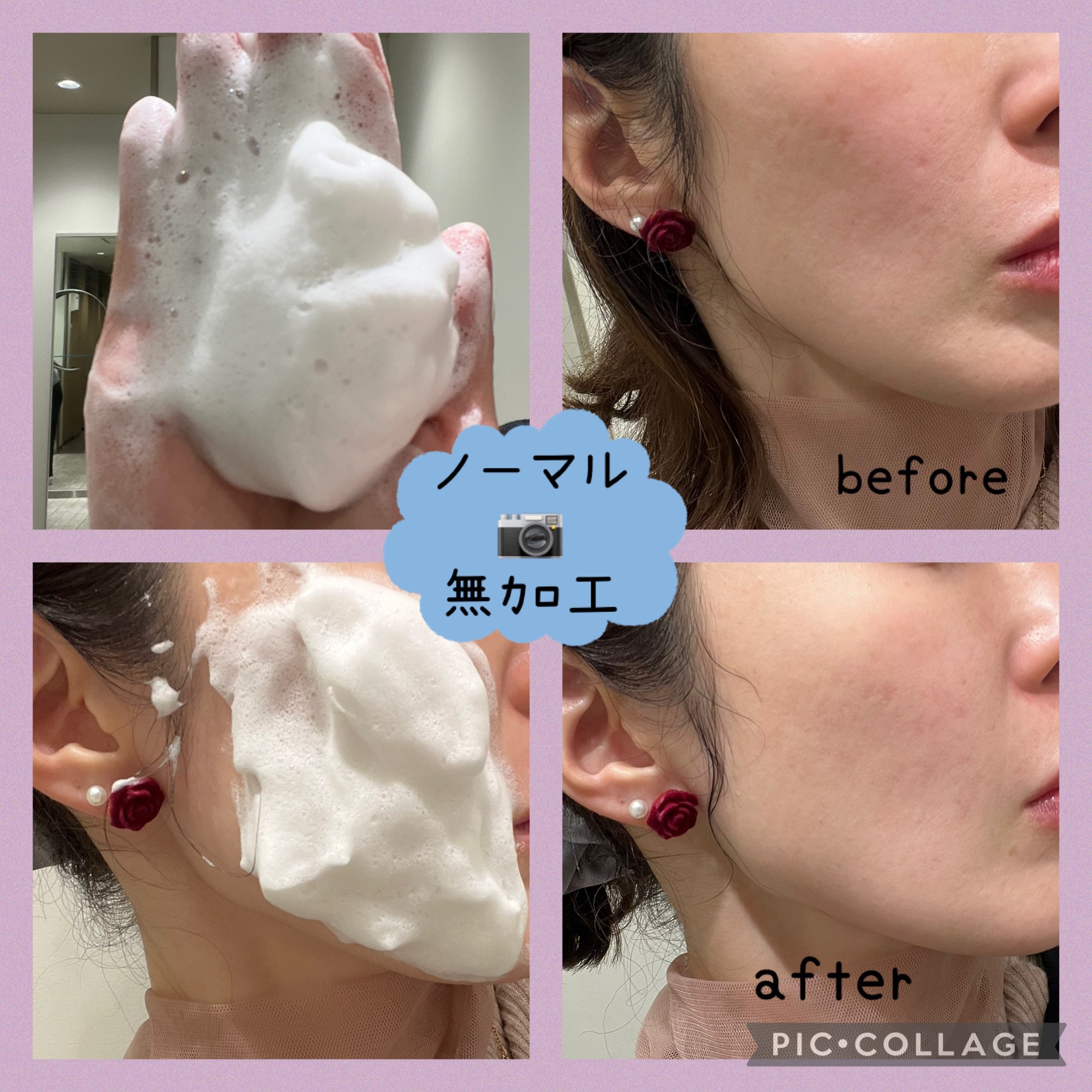 SBC MEDISPA ステムピールソープ/SBC MEDISPA/洗顔石鹸を使ったクチコミ（2枚目）