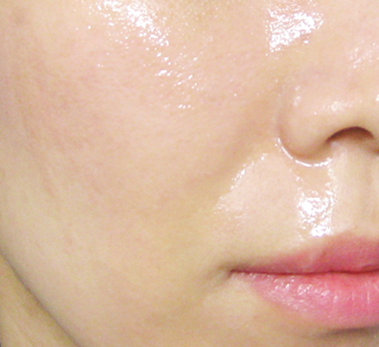 シックヒーラーアンプル/itfu/美容液を使ったクチコミ(2枚目)