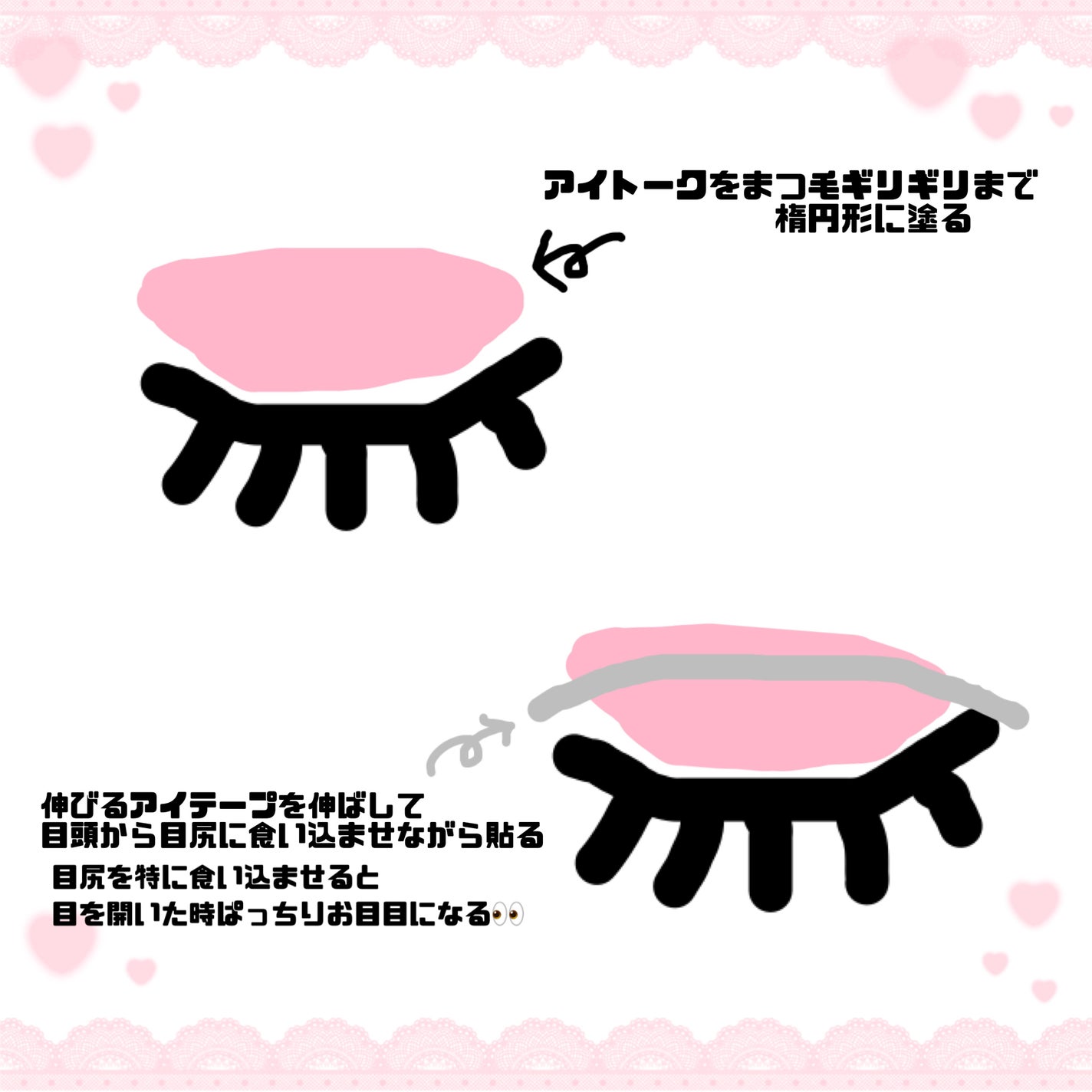 のびーるアイテープ(絆創膏タイプ、レギュラー)/DAISO/二重まぶた用アイテムを使ったクチコミ(5枚目)