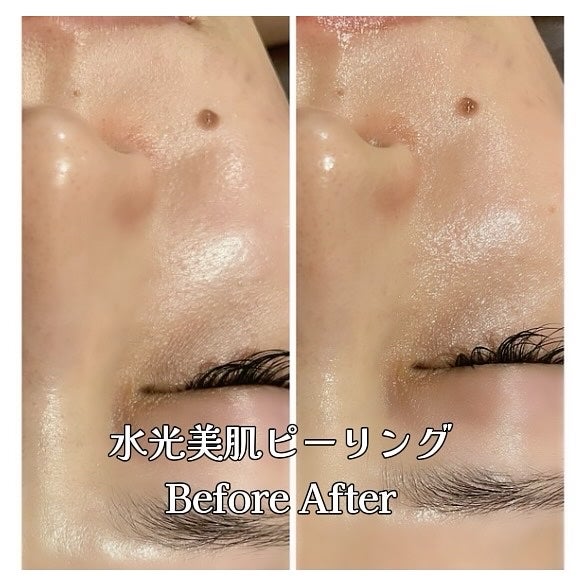 青山ニナ@コスメコンシェルジュインストラクター on LIPS 「医療じゃなくてもここまでのケアができる時代東京美肌管理サロン(..」(4枚目)