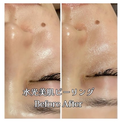 青山ニナ@コスメコンシェルジュインストラクター on LIPS 「医療じゃなくてもここまでのケアができる時代東京美肌管理サロン(..」(4枚目)