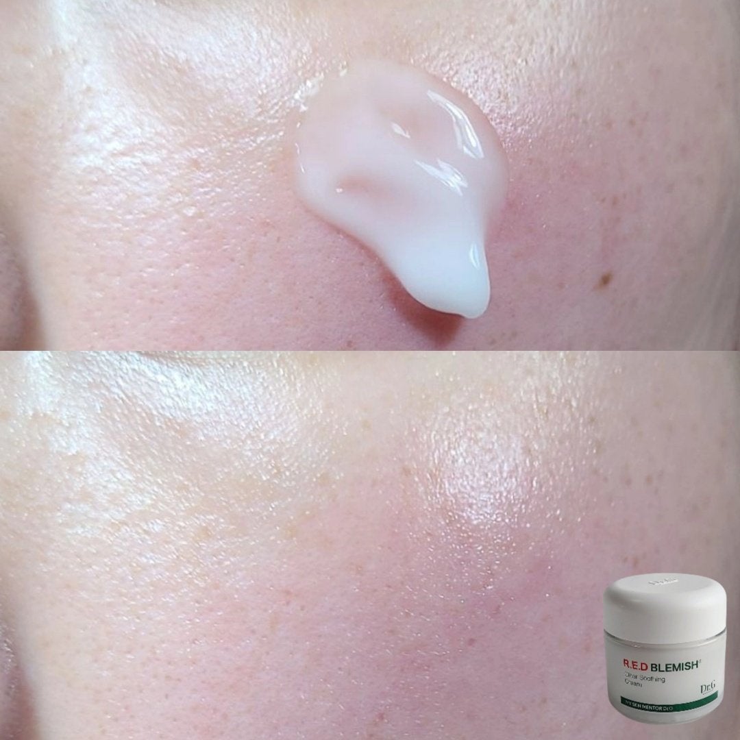 レッドブレミッシュ クリアスージングクリーム/Dr.G/フェイスクリームを使ったクチコミ(4枚目)