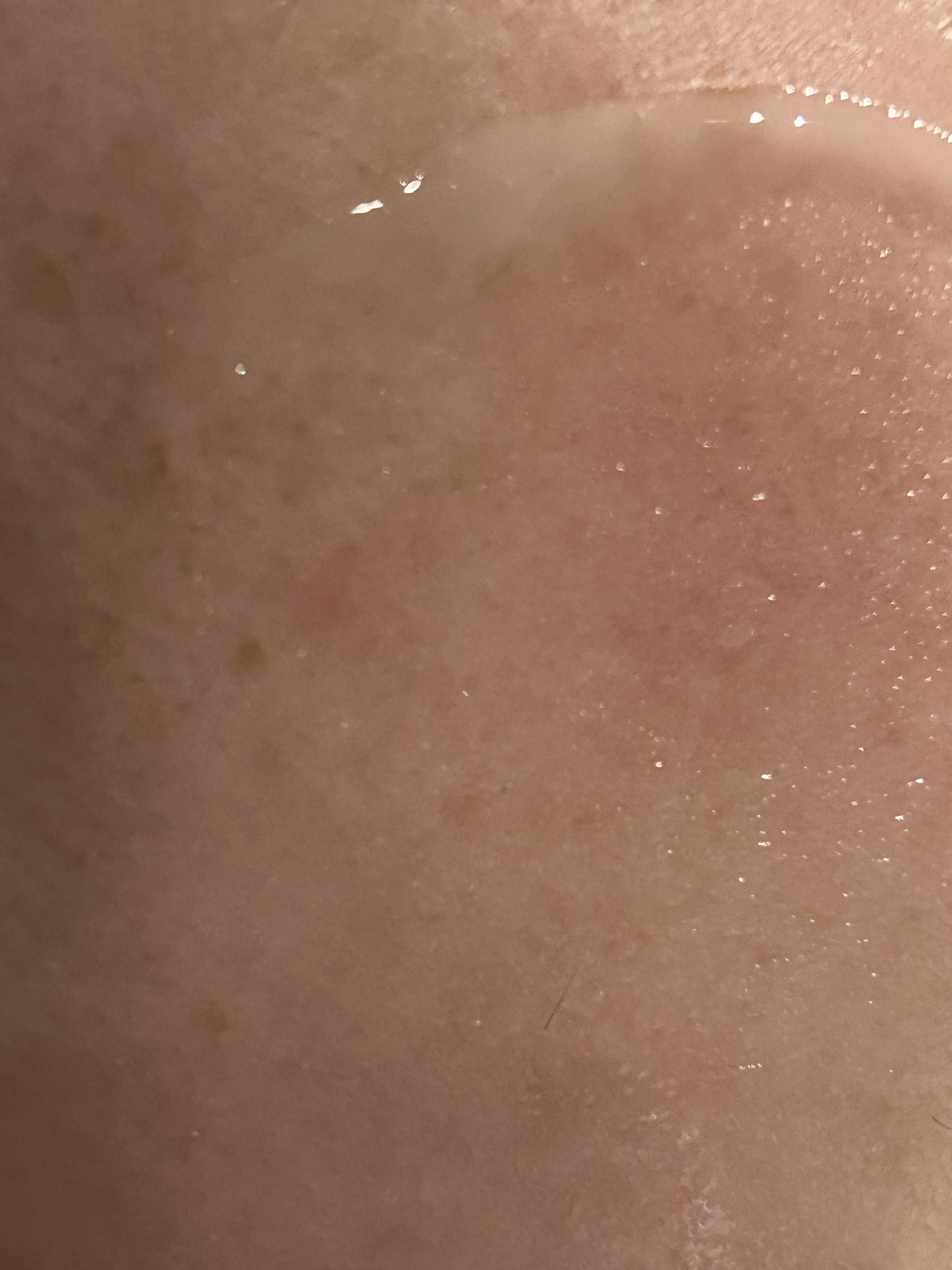 プロバイオシカ インテンシブ アンプル/SKIN1004/美容液を使ったクチコミ（3枚目）