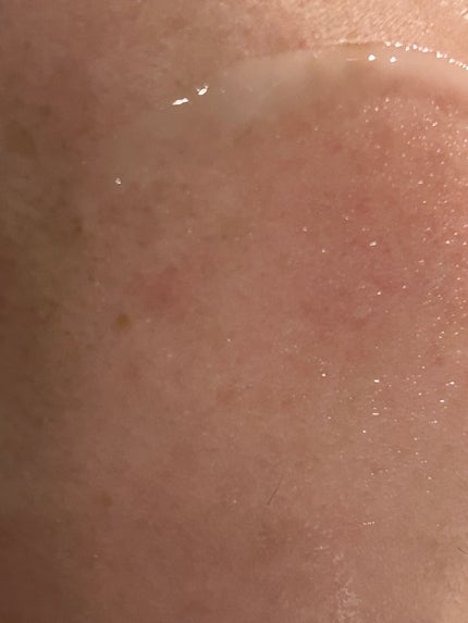 プロバイオシカ インテンシブ アンプル/SKIN1004/美容液を使ったクチコミ(3枚目)