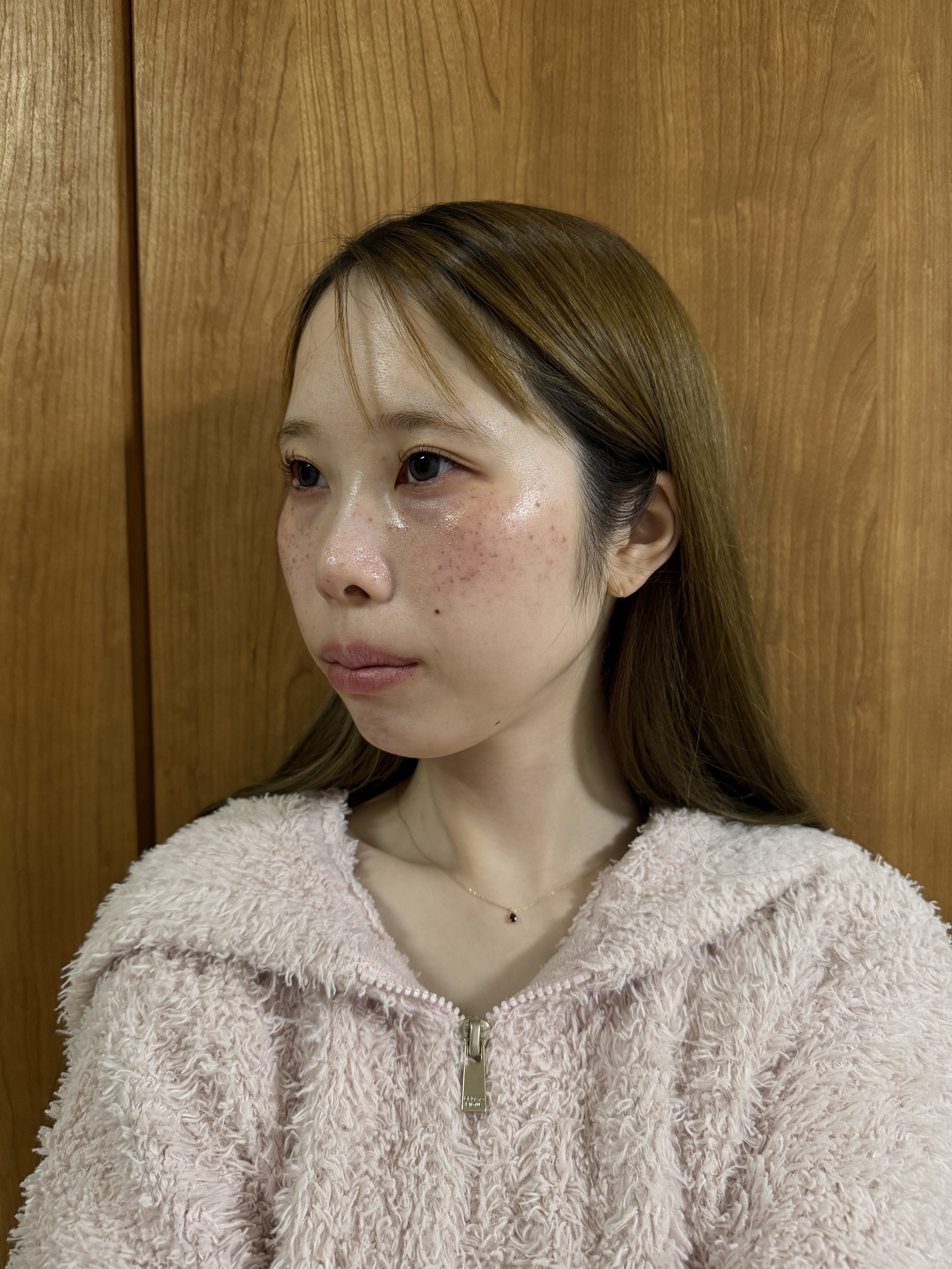 UVフォーミュラゼリー/Cell Fusion C(セルフュージョンシー)/美容サプリメントを使ったクチコミ（2枚目）