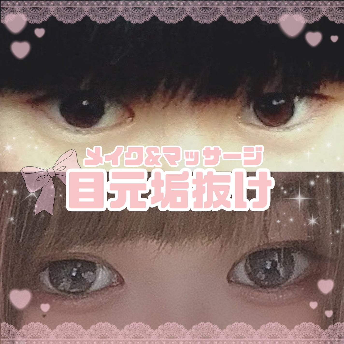 のびーるアイテープ(絆創膏タイプ、レギュラー)/DAISO/二重まぶた用アイテムを使ったクチコミ(1枚目)