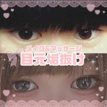 アイテープ(絆創膏タイプ、レギュラー、70枚)/DAISO/二重まぶた用アイテムを使ったクチコミ(1枚目)