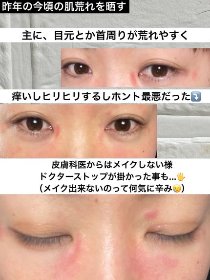 ðç«å¥œããã«ã³ðæ°ãŸãããŒã¡ãŒã¡æçš¿ðŸé »åºŠäžãããŸãðŠ on LIPS ã#èèãäºé²èšç»#ãããè#è質æ¹åãä»å¹Žã¯èª¿åè¯ãðäœæ
ãªã®..ãïŒ2æç®ïŒ