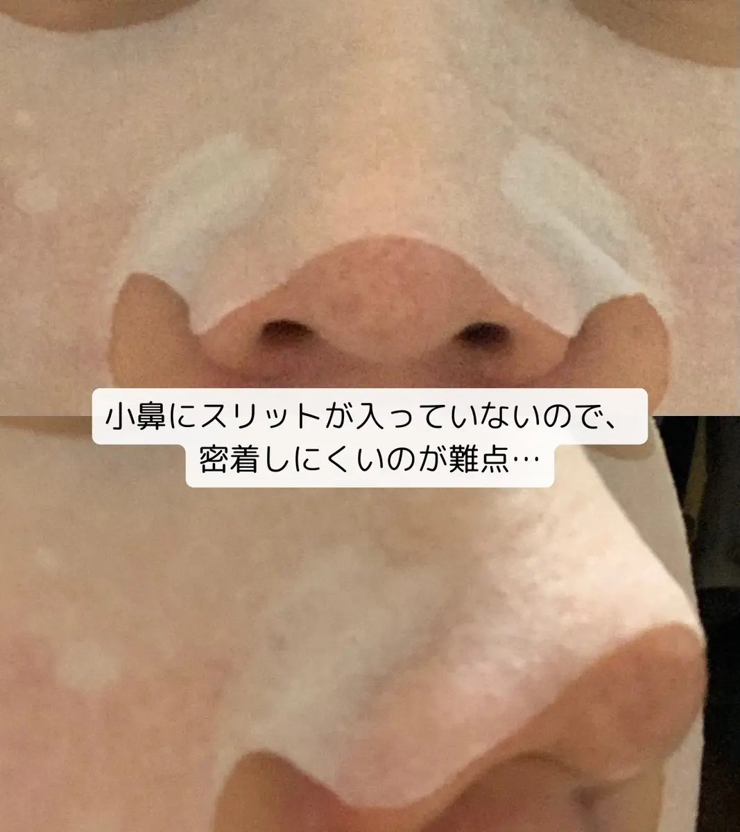 ルルルン ハイドラ V マスク/ルルルン/シートマスク・パックを使ったクチコミ（3枚目）