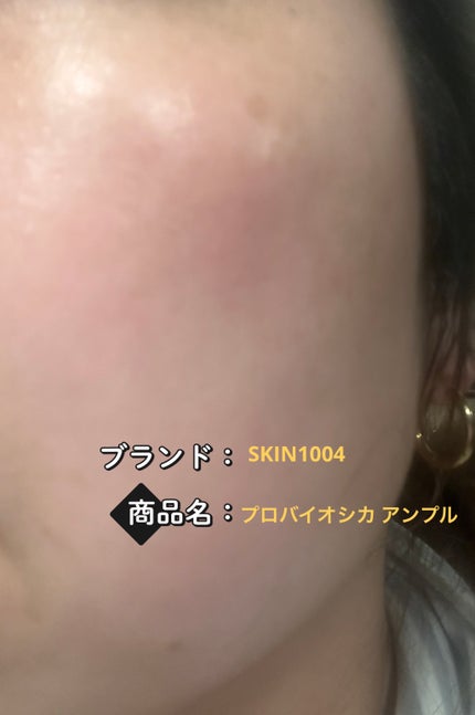 プロバイオシカ インテンシブ アンプル/SKIN1004/美容液を使ったクチコミ(4枚目)