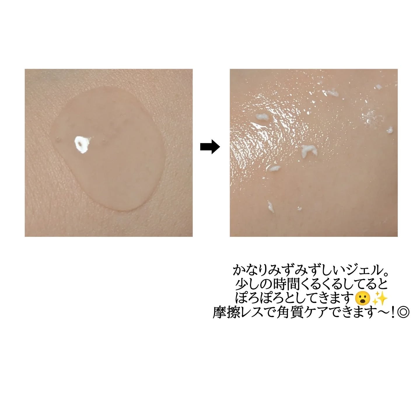 ナチュラルアクアジェル/Cure/ピーリングを使ったクチコミ（3枚目）