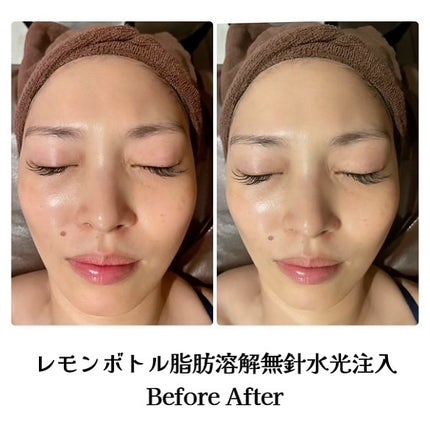 青山ニナ@コスメコンシェルジュインストラクター on LIPS 「医療じゃなくてもここまでのケアができる時代東京美肌管理サロン(..」(6枚目)