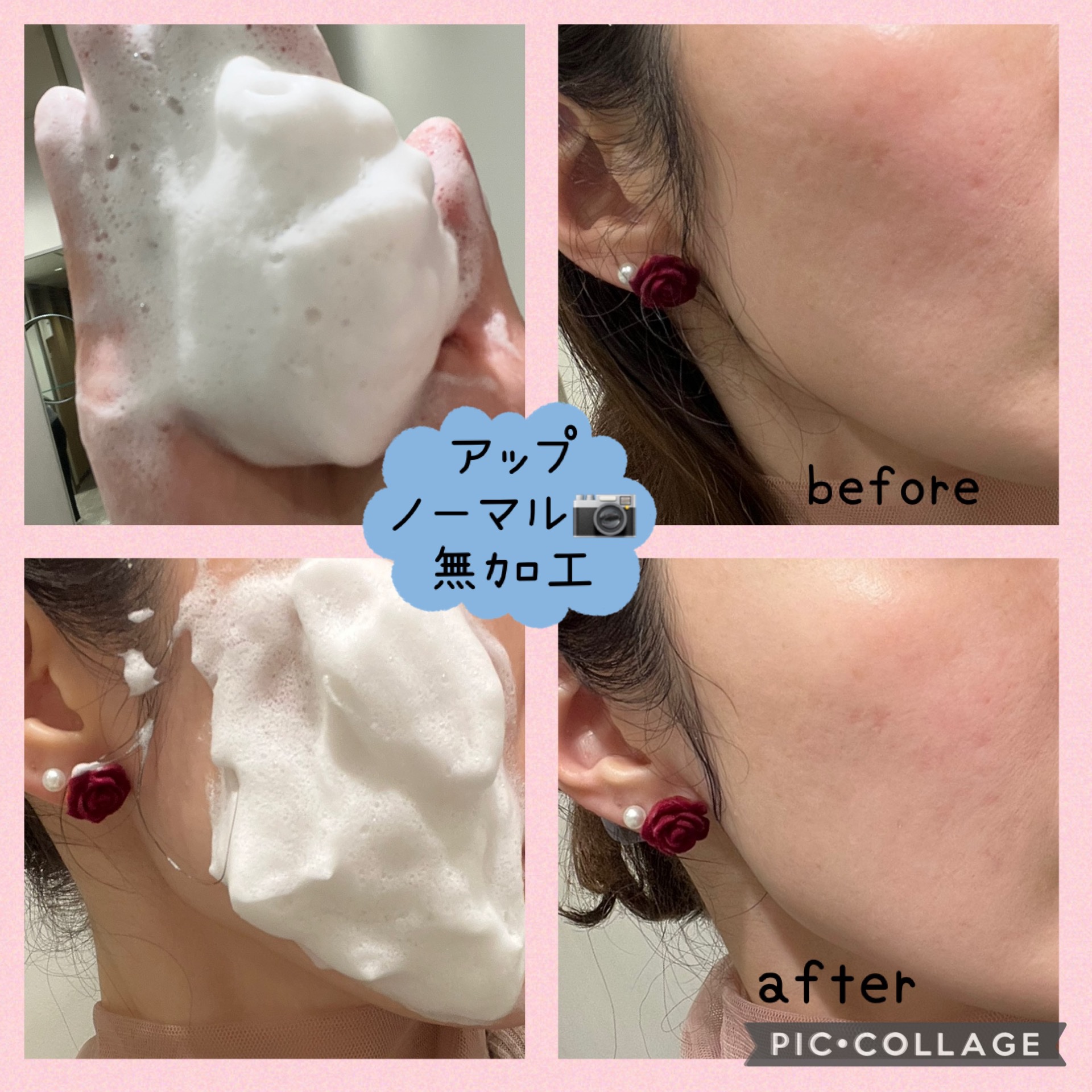 SBC MEDISPA ステムピールソープ/SBC MEDISPA/洗顔石鹸を使ったクチコミ（3枚目）