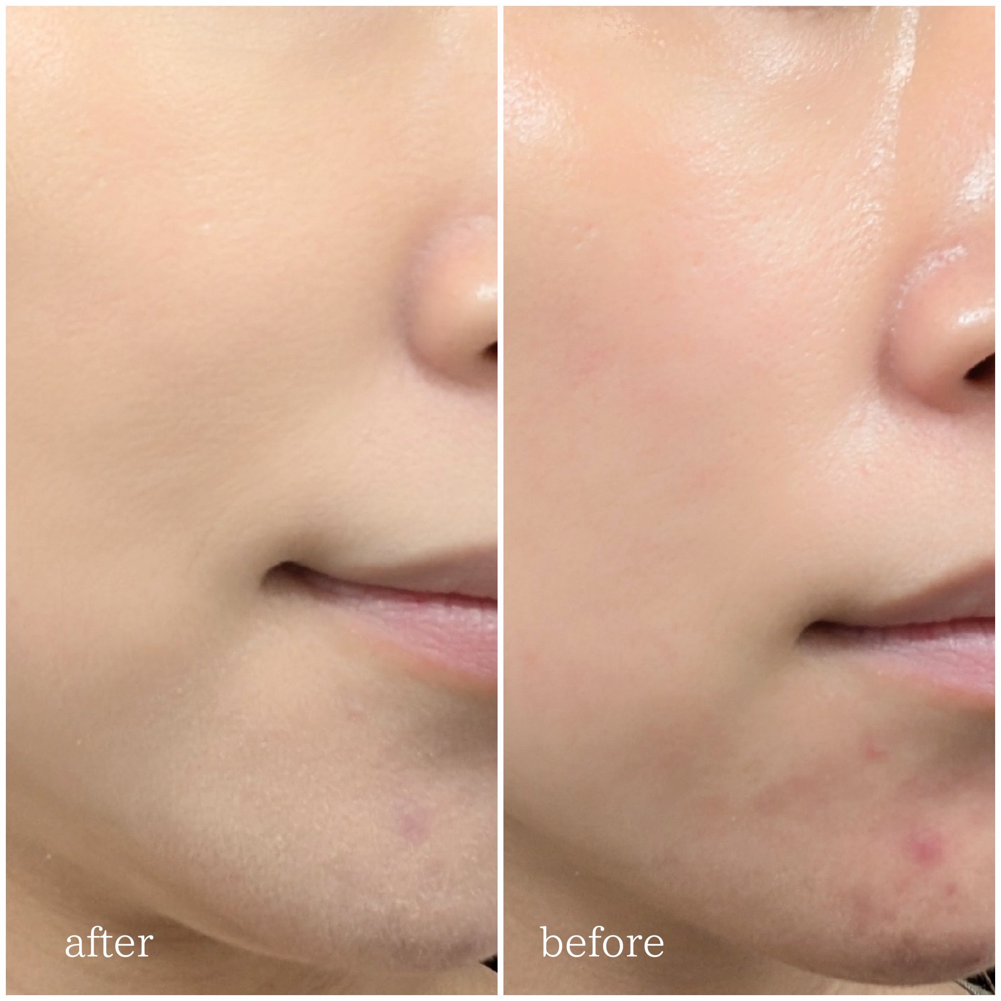 シカマヌ　セラム　イン　マット　クッション/parnell/クッションファンデーションを使ったクチコミ（2枚目）