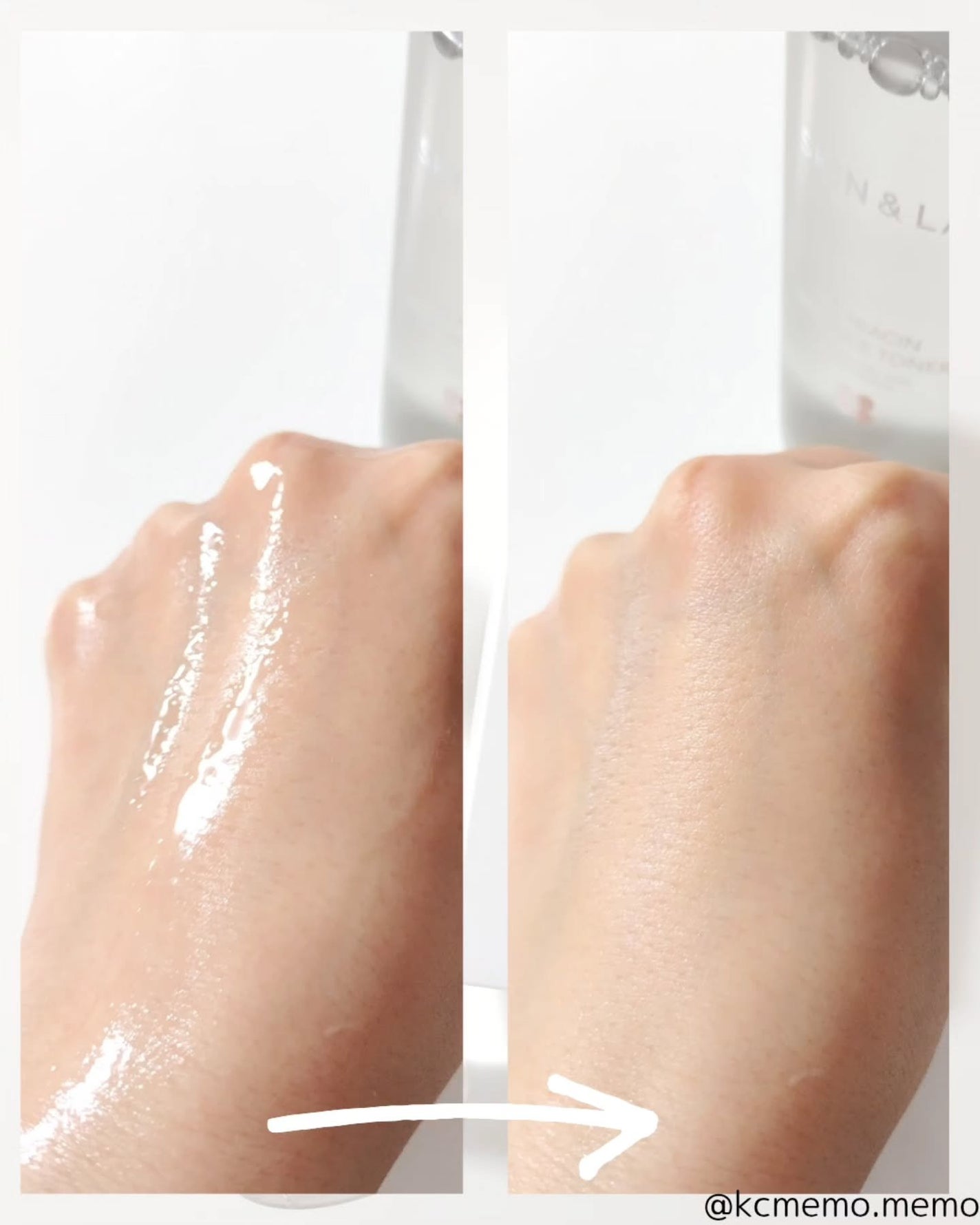 TXナイアシンエッセンストナー/SKIN&LAB/化粧水を使ったクチコミ(4枚目)