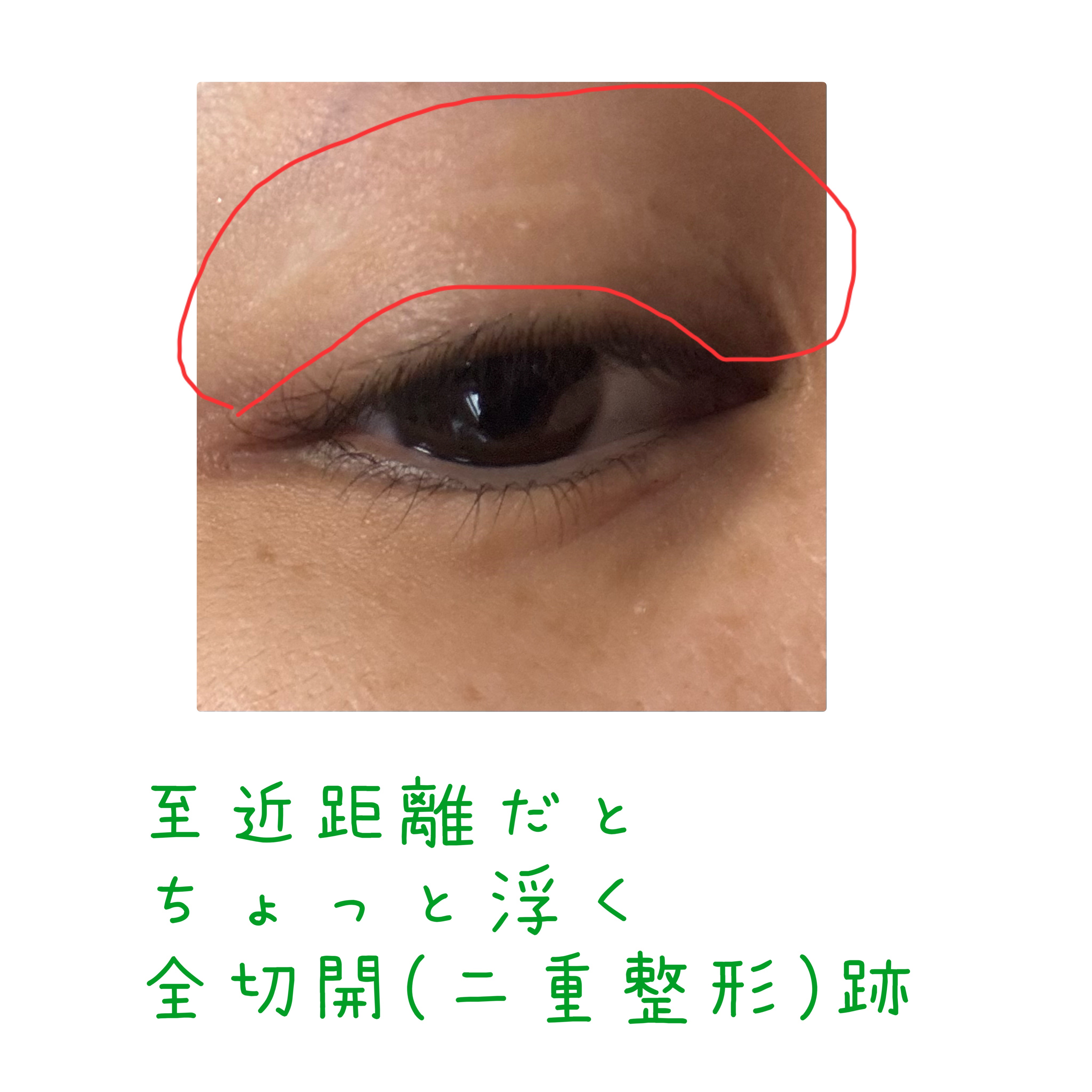 グリッター シャドウ カラー/rom&nd/グリッターを使ったクチコミ（2枚目）