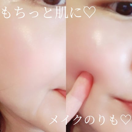 イチジク毛穴アンプル/Veganifect/美容液を使ったクチコミ(7枚目)