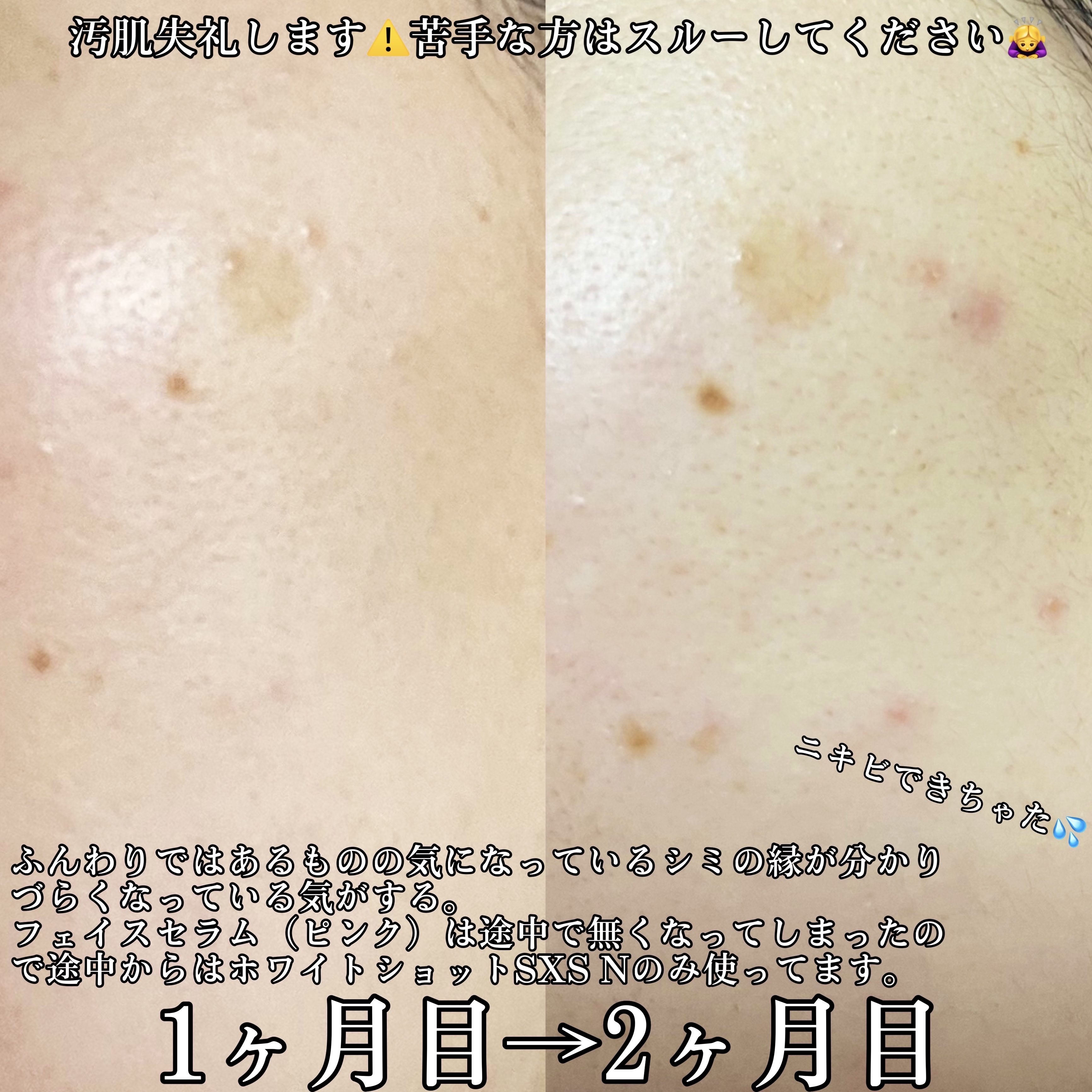 ホワイトショット SXS N/ホワイトショット/美容液を使ったクチコミ（3枚目）