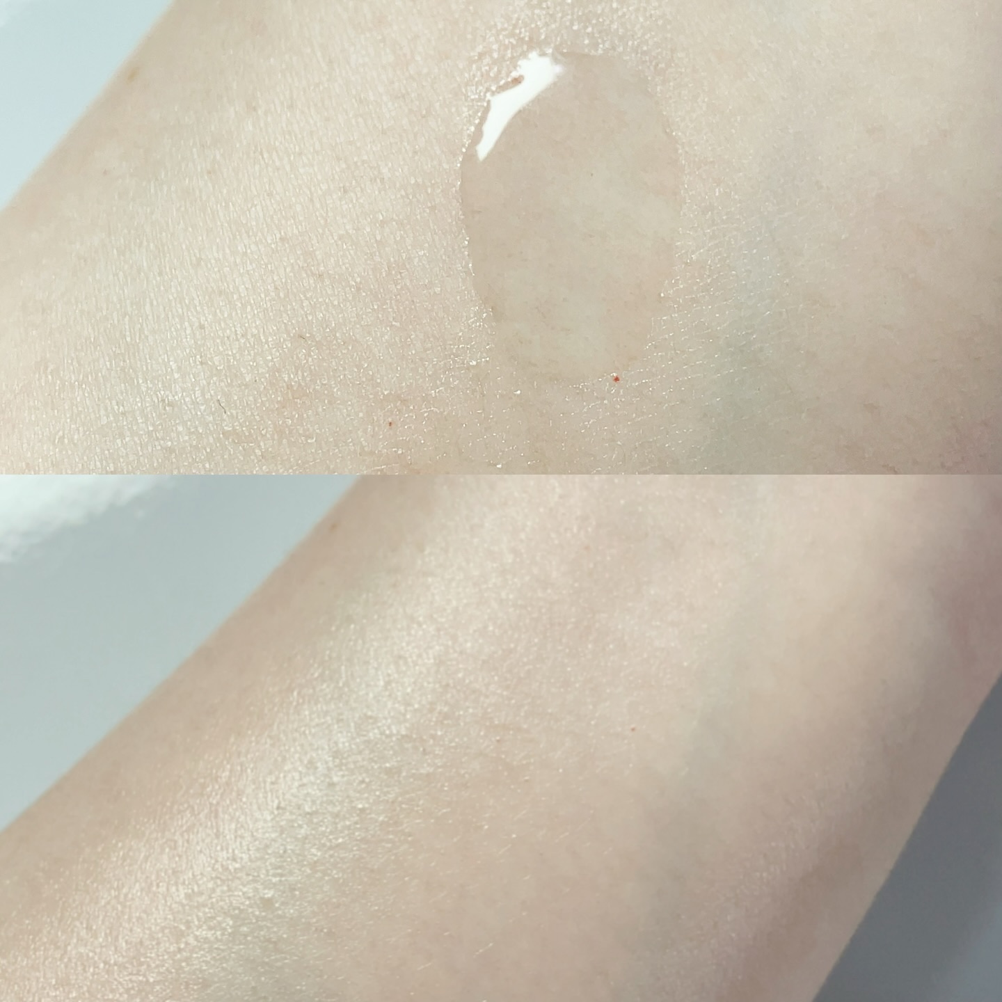 ダーマアンサーアゼライン酸ミントアンプル/CNP Laboratory/美容液を使ったクチコミ（3枚目）