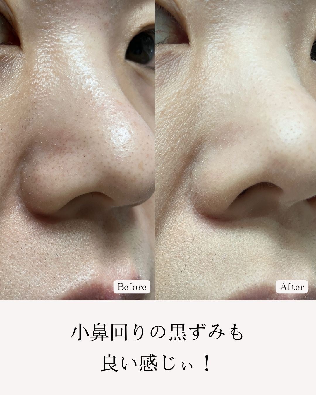 ソフトマットプレストパウダー/FUNNY ELVES方里/プレストパウダーを使ったクチコミ(6枚目)