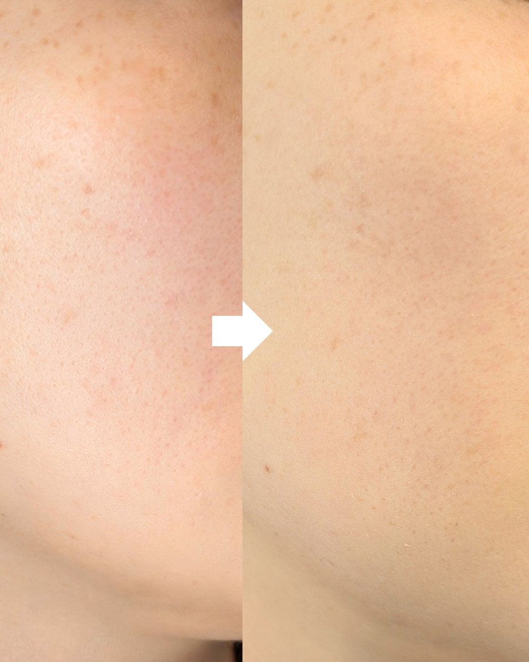 ベアプロ 24HR パウダー ファンデーション/bareMinerals/パウダーファンデーションを使ったクチコミ(5枚目)