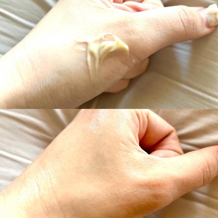 セメンリトカルシウムアンプル+セメンリトカルシウムクリーム/Dr.Melaxin/スキンケアキットを使ったクチコミ(7枚目)