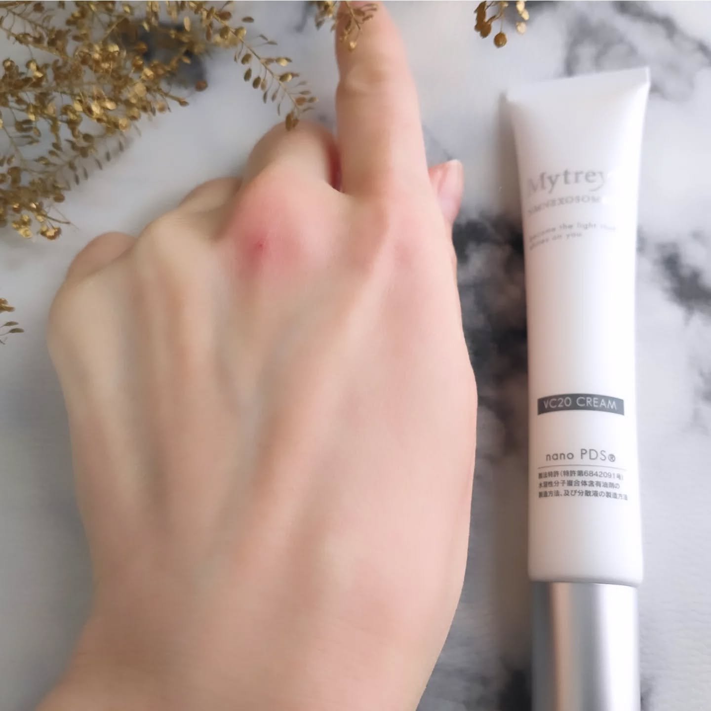 試してみた】Mytreya VC20 CREAM Mytreyaの効果・肌質別の口コミ