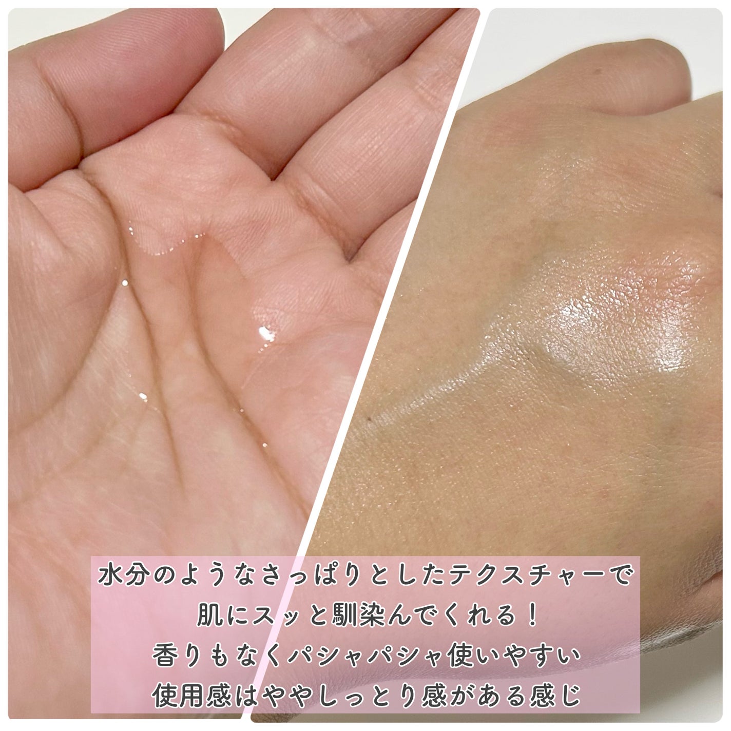 TXナイアシンエッセンストナー/SKIN&LAB/化粧水を使ったクチコミ(4枚目)