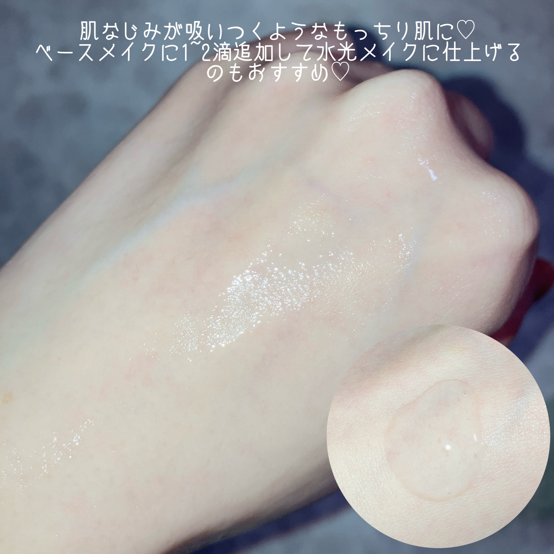 リマージ糸リフティングアンプル/REVENIP/美容液を使ったクチコミ（3枚目）