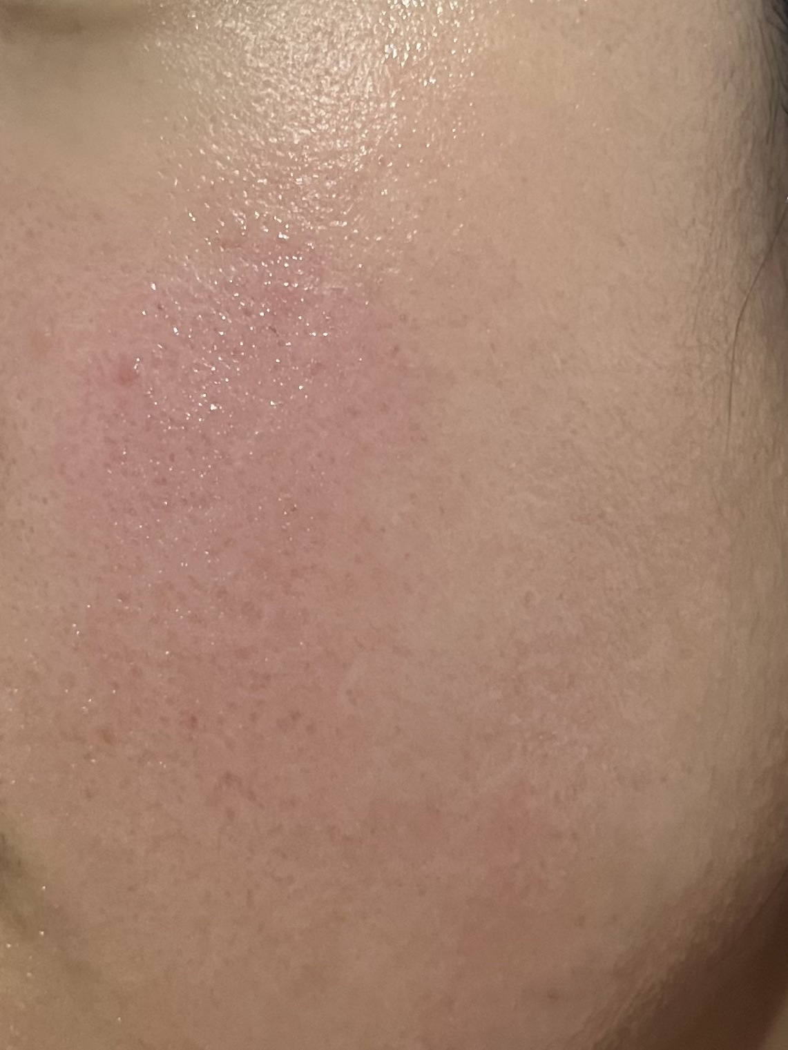 クリアエッセンスマスク/ピュレア/シートマスク・パックを使ったクチコミ（2枚目）