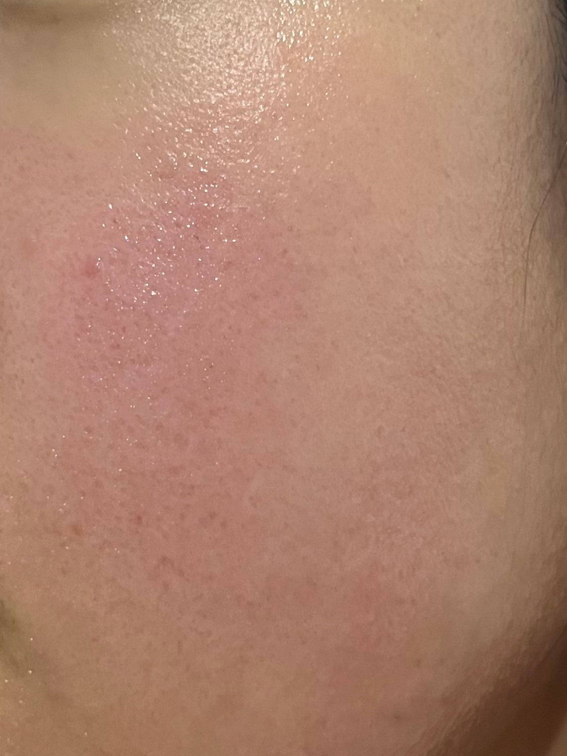 クリアエッセンスマスク/ピュレア/シートマスク・パックを使ったクチコミ(2枚目)